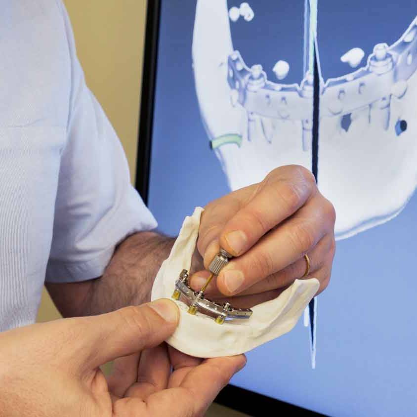 Andrew Dawood holding a jaw model and demonstrating Trefoil Dental Implant system